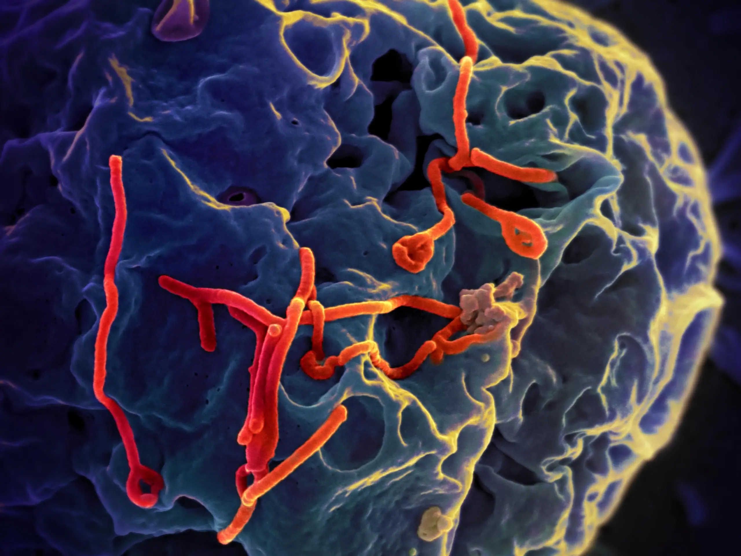 Ebola se širi u Kongu i Ugandi, potvrđeni novi slučajevi zaraze